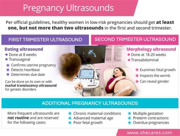 Are prenatal ultrasounds covered by insurance?