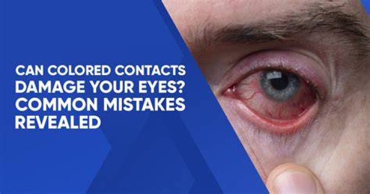 Can colored contacts damage your eyes?