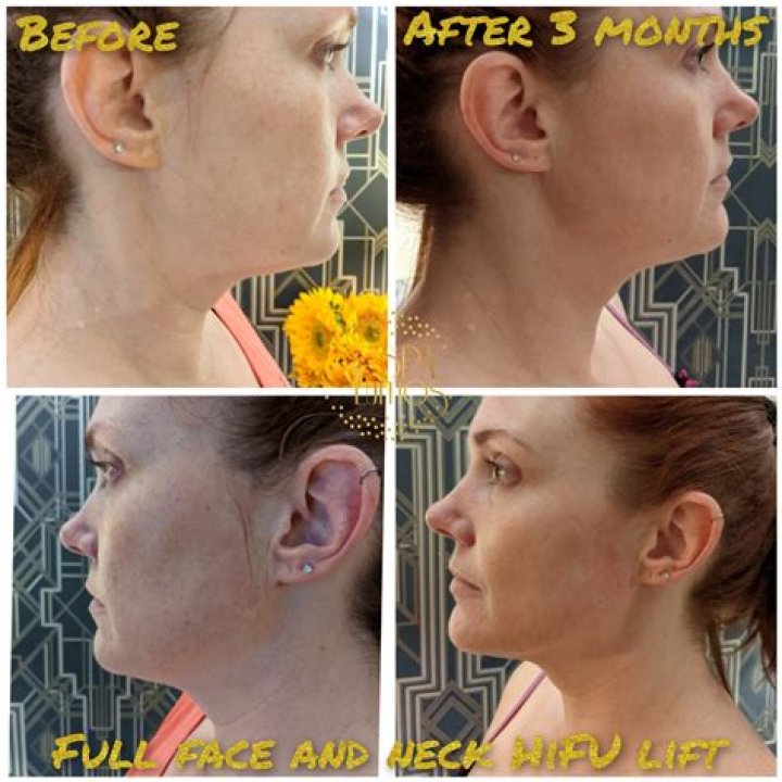 Can we use cement after 3 months?