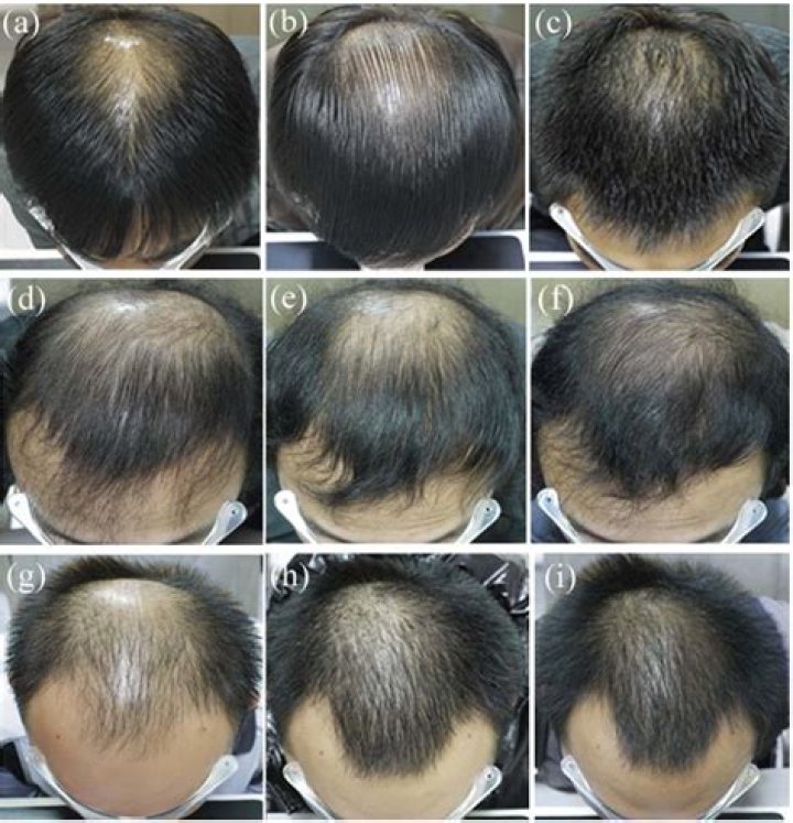Can we use cement after 6 months?