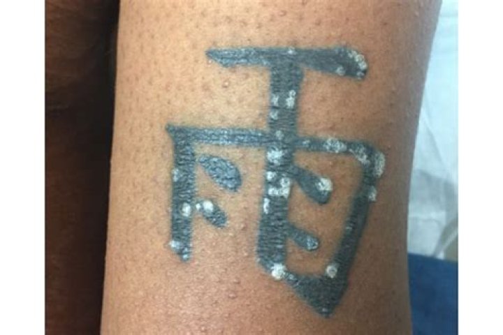Does having a face tattoo affect getting a job?