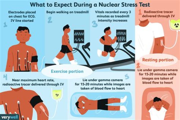 What are the requirements for a nuclear stress test?