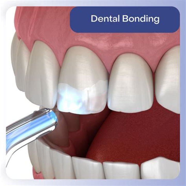 What does a bonding agent do?
