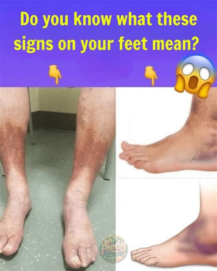 What does the phrase on your feet mean?