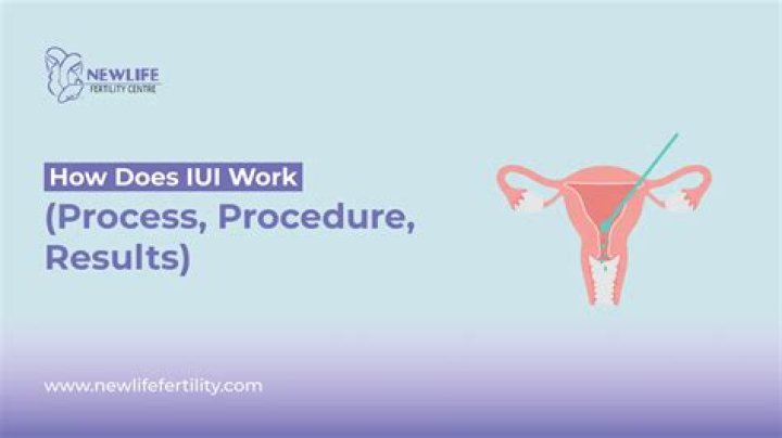 What does work procedure mean?