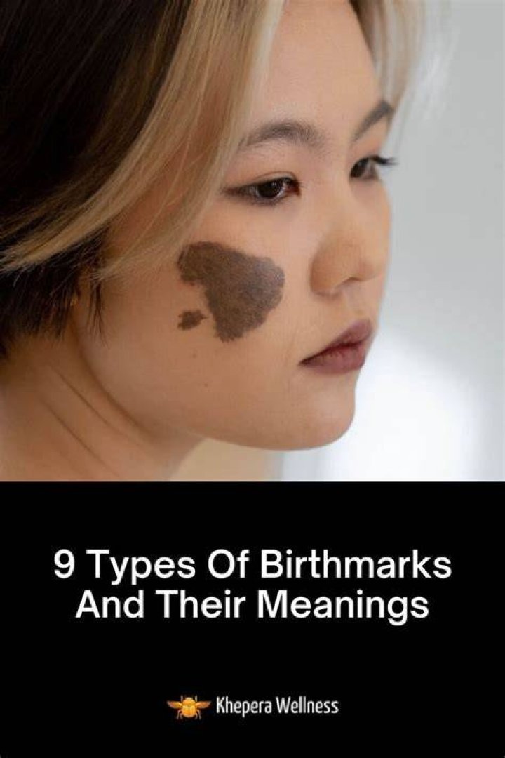 Why is it called a logo?